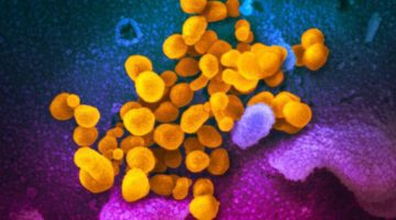 Coronavirus Public Health Blog 4.5.20 – Why Are Symptoms So Varied?